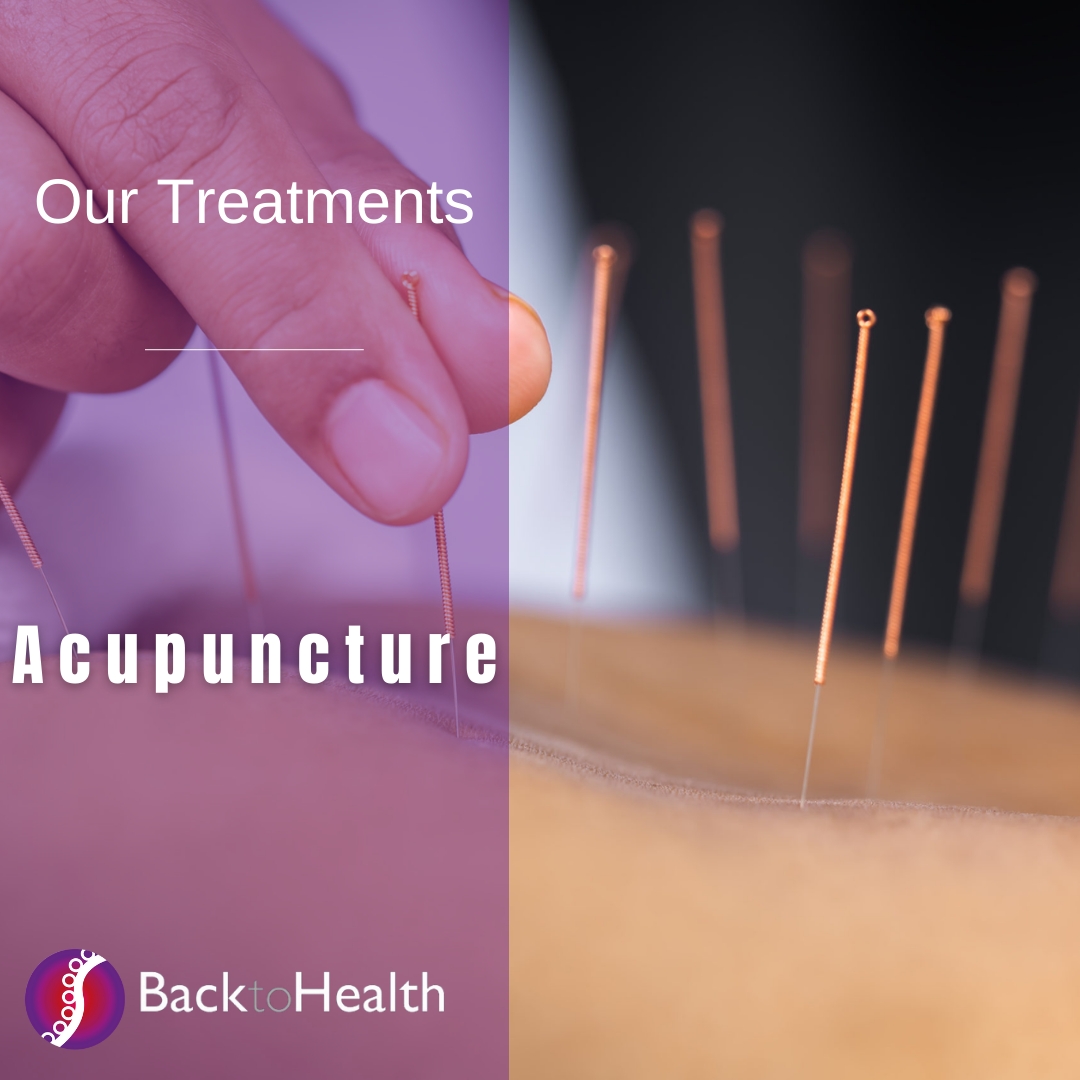 Our Services Acupuncture 